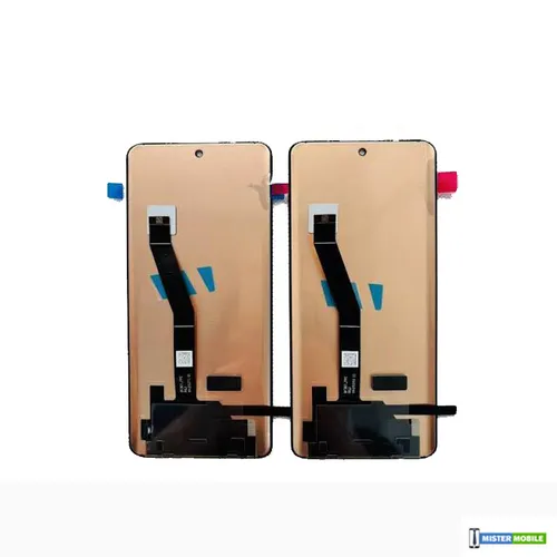 Xiaomi Redmi Note 15 Display Replacement with Free Installation